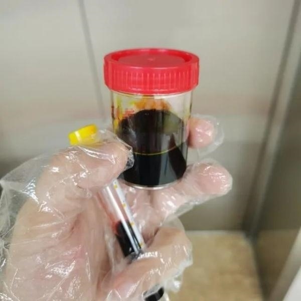 急性肝衰竭！兩兄弟誤吃這種菌 專家提醒