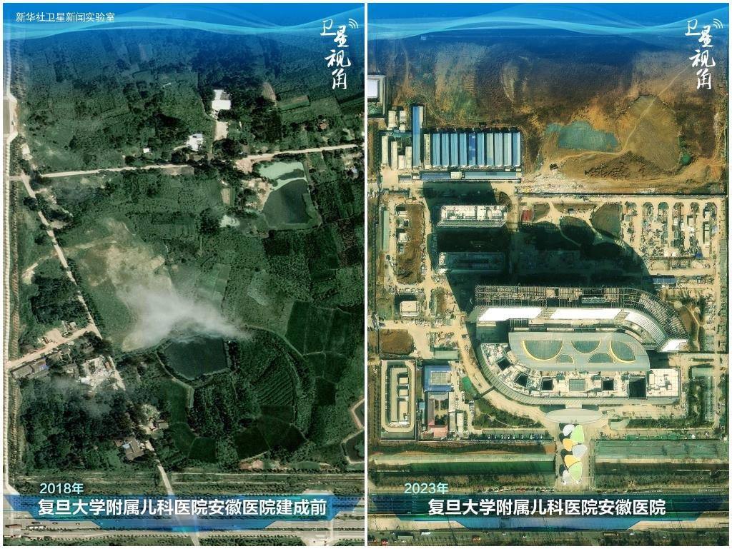 2023年與2018年相比，復(fù)旦大學(xué)附屬兒科醫(yī)院安徽醫(yī)院從一片荒地到建成投用。該項目是安徽省在長三角一體化高質(zhì)量發(fā)展衛(wèi)生健康領(lǐng)域的重大項目，也是安徽首批落地的國家區(qū)域醫(yī)療中心。